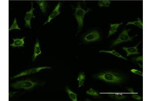 Immunofluorescence of monoclonal antibody to RARA on HeLa cell. (Retinoic Acid Receptor alpha anticorps  (AA 315-424))
