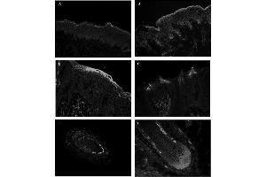 Immunohistochemical staining of repetin using anti-Repetin, pAb (AF646)  and FITC-labeled anti-rabbit IgG antibody on frozen section of human skin (A), human foreskin (B), human tongue (C and D) and human hair follicles (E and F).