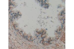 IHC-P analysis of prostate gland tissue, with DAB staining. (PSMA anticorps  (AA 536-752))
