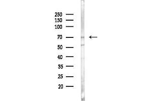 Western blot analysis of lysates from Hela cells(starvation 24h treatment), using SDC1 Antibody at 1/1000 dilution.