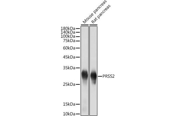 PRSS2 anticorps