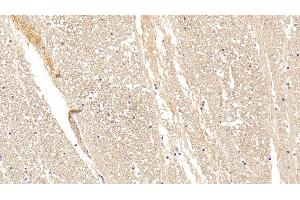Detection of CPLX1 in Human Cerebrum Tissue using Polyclonal Antibody to Complexin 1 (CPLX1)