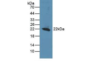 Detection of Recombinant REV1, Human using Polyclonal Antibody to REV1 Homolog (REV1) (REV1 anticorps  (AA 301-478))