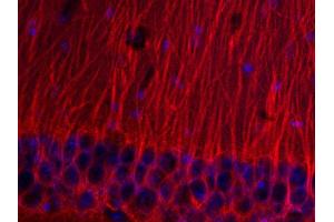 Immunohistochemistry (IHC) image for anti-Tubulin, beta 3 (TUBB3) (AA 443-450) antibody (ABIN1742553)