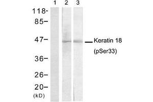Western blot analysis of extracts from A431 cells (Lane 1 and 2) and EC-304 cells (Lane 3) using Keratin 18 (Phospho-Ser33) antibody (E011306). (Cytokeratin 18 anticorps  (pSer33))