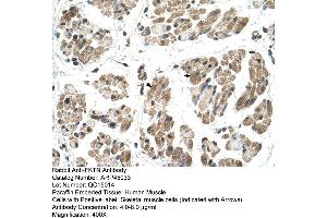 Human Muscle (Fukutin anticorps  (N-Term))