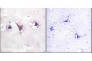 Immunohistochemistry analysis of paraffin-embedded human brain tissue, using Trk B (Ab-515) Antibody.