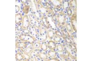 Immunohistochemistry of paraffin-embedded rat kidney using SIRT3 antibody.