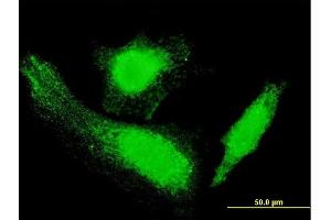 Immunofluorescence of monoclonal antibody to HTT on HeLa cell.