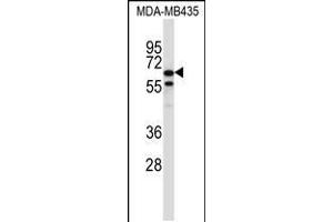 Western blot analysis in MDA-MB435 cell line lysates (35ug/lane). (TRIM39 anticorps  (AA 248-277))