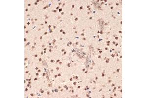 Immunohistochemistry of paraffin-embedded mouse brain using EHMT2 Rabbit mAb (ABIN7265616) at dilution of 1:100 (40x lens). (EHMT2 anticorps)