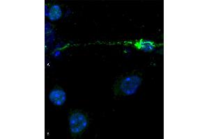 Phospho serine 129 antibody (ABIN5650947) was used to detect phosphorylated alpha synuclein in primary mouse hippocampal neurons treated with 100 nM sonicated mouse alpha synuclein PFFs (ABIN5651245) (A). (SNCA anticorps  (pSer129) (Biotin))