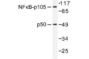 Image no. 1 for anti-Nuclear Factor of kappa Light Polypeptide Gene Enhancer in B-Cells 1 (NFKB1) antibody (ABIN271742) (NFKB1 anticorps)