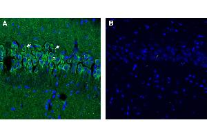Free-floating frozen brain sections from a paraformaldehyde-perfused mouse were incubated with Anti-Synaptojanin 1 antibody (ABIN7885553, 1:300), followed by goat anti-rabbit secondary antibody conjugated to Alexa Fluor® 488 (green). (Synaptojanin 1 anticorps  (Intracellular))