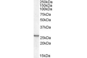 Image no. 2 for anti-Cysteine and Glycine-Rich Protein 2 (CSRP2) (Internal Region) antibody (ABIN374898) (CSRP2 anticorps  (Internal Region))