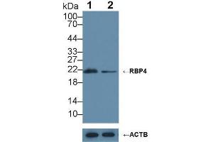 Western blot analysis of (1) Wild-type HepG2 cell lysate, and (2) RBP4 knockout HepG2 cell lysate, using Rabbit Anti-Cow RBP4 Antibody (1 µg/ml) and HRP-conjugated Goat Anti-Mouse antibody ( (RBP4 anticorps  (AA 19-201))