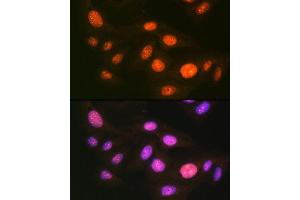 Immunofluorescence analysis of U-2 OS cells using UB Rabbit mAb (ABIN7271185) at dilution of 1:100 (40x lens). (UBA1 anticorps)