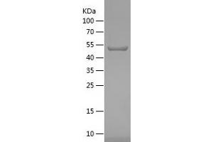 Western Blotting (WB) image for Heme Oxygenase (Decycling) 1 (HMOX1) (AA 1-267) protein (His-IF2DI Tag) (ABIN7123289)