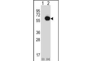 Western blot analysis of RANG (arrow) using rabbit polyclonal RANG Antibody (N-term) 3776a. (RANGAP1 anticorps  (N-Term))