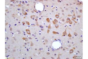 Formalin-fixed and paraffin embedded rat brain labeled with Rabbit Anti-HES6 Polyclonal Antibody, Unconjugated (ABIN1387271) at 1:200 followed by conjugation to the secondary antibody and DAB staining (HES6 anticorps  (AA 1-80))