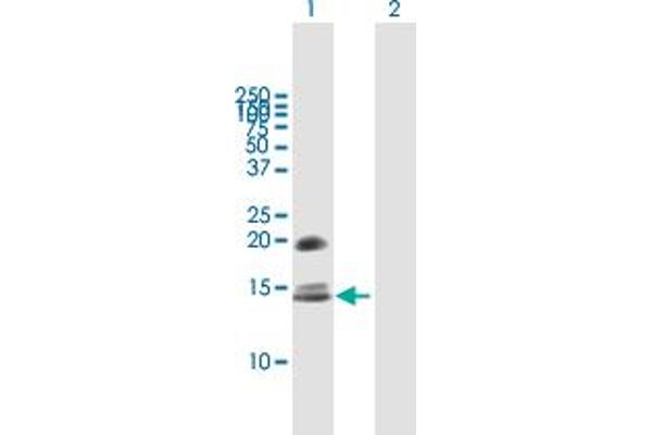 CRB3 抗体  (AA 1-120)