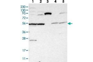 Western blot analysis of Lane 1: RT-4, Lane 2: U-251 MG, Lane 3: Human Plasma, Lane 4: Liver, Lane 5: Tonsil with SLC35F1 polyclonal antibody  at 1:250-1:500 dilution. (SLC35F1 anticorps)