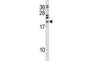 ATF3 antibody western blot analysis in CEM lysate. (ATF3 anticorps  (AA 140-168))