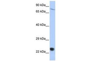 Image no. 1 for anti-SP110 Nuclear Body Protein (SP110) (AA 612-661) antibody (ABIN6742727)