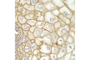 Immunohistochemistry of paraffin-embedded human esophageal using HLA-A antibody at dilution of 1:100 (400x lens).