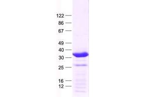 Validation with Western Blot