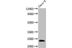 Western Blot Positive WB detected in: Caco-2 whole cell lysate All lanes: CLDN3 antibody at 3. (Claudin 3 anticorps  (AA 181-220))