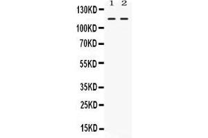 Western blot analysis of Argonaute 4 expression in rat thymus extract ( Lane 1) and 22RV1 whole cell lysates ( Lane 2). (AGO4 anticorps  (N-Term))