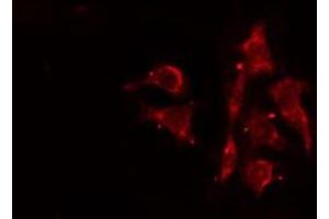ABIN6276478 staining Hela cells by IF/ICC. (ACTR3 anticorps  (C-Term))