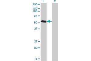 Western Blot analysis of FOXA1 expression in transfected 293T cell line by FOXA1 monoclonal antibody (M01), clone 2D7. (FOXA1 anticorps  (AA 367-472))
