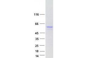 Validation with Western Blot