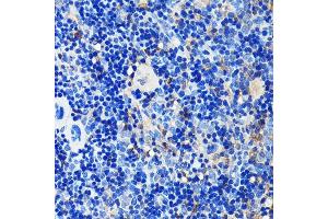 Immunohistochemistry of paraffin-embedded mouse spleen using GRB2 Rabbit mAb (ABIN7267518) at dilution of 1:100 (40x lens).