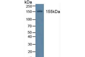 Figure. (Insulin Receptor anticorps  (AA 1027-1364))