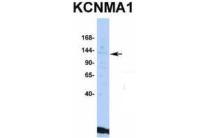 Host:  Rabbit  Target Name:  KCNMA1  Sample Type:  HepG2  Antibody Dilution:  1. (KCNMA1 anticorps  (C-Term))