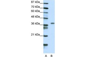 Western Blotting (WB) image for anti-Mesenchyme Homeobox 2 (MEOX2) antibody (ABIN2460538) (MEOX2 anticorps)