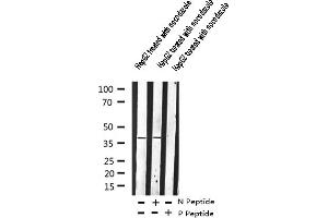Western blot analysis of Adrenergic Receptor beta2 phosphorylation expression in nocodazole treated HepG2 whole cell lysates