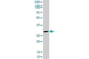 CDK4 monoclonal antibody (M09), clone 8A10. (CDK4 anticorps  (AA 211-303))