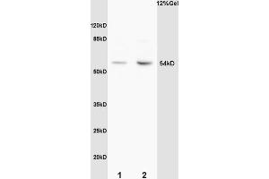 L1 mouse brain lysates L2 mouse embryo lysates probed with Anti Phospho-MEF2A (Thr312) Polyclonal Antibody, Unconjugated (ABIN743768) at 1:200 overnight at 4 °C. (MEF2A anticorps  (pThr312))
