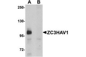 Western blot analysis of ZC3HAV1 in HeLa cell lysate with ZC3HAV1 antibody at 1μg/ml in (A) the absence and (B) the presence of blocking peptide. (ZC3HAV1 anticorps  (C-Term))