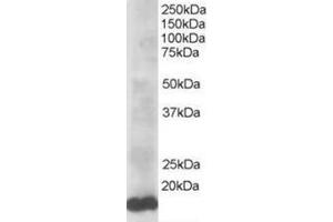 Image no. 1 for anti-Ubiquitin-Conjugating Enzyme E2L 3 (UBE2L3) (C-Term) antibody (ABIN374293) (UBE2L3 anticorps  (C-Term))