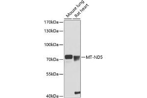 Western blot analysis of extracts of various cell lines, using MT-ND5 antibody (ABIN6135115, ABIN6144434, ABIN6144436 and ABIN6216103) at 1:1000 dilution. (MT-ND5 anticorps  (AA 300-400))