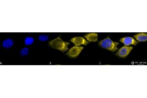 Immunocytochemistry/Immunofluorescence analysis using Rabbit Anti-SOD (Mn) Polyclonal Antibody . (SOD2 anticorps  (Biotin))