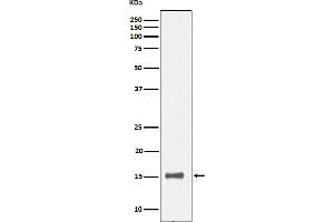 Western blot analysis of IL13 expression in human recombinant protein cell lysate.