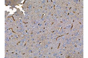 ABIN6257649 and ABIN6275602 at 1/100 staining rat brain tissue by IHC-P. (Sorting Nexin 4 anticorps  (Internal Region))