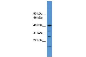 WB Suggested Anti-SCAMP1 Antibody Titration: 0. (SCAMP1 anticorps  (Middle Region))