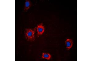 Immunofluorescent analysis of AKT staining in MCF7 cells. (AKT1 anticorps  (Center))